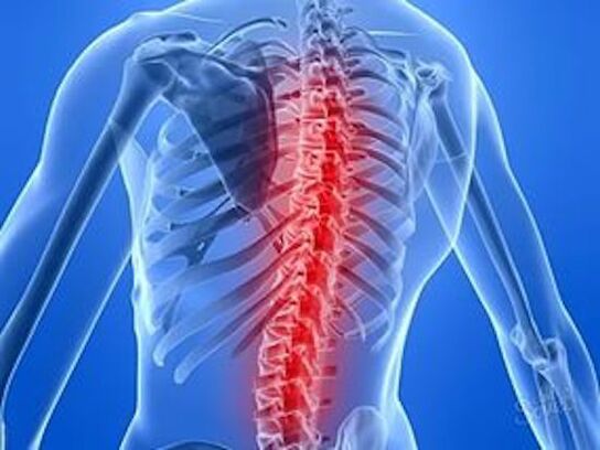 η νόσος της σπονδυλικής στήλης προκαλεί πόνο στην πλάτη
